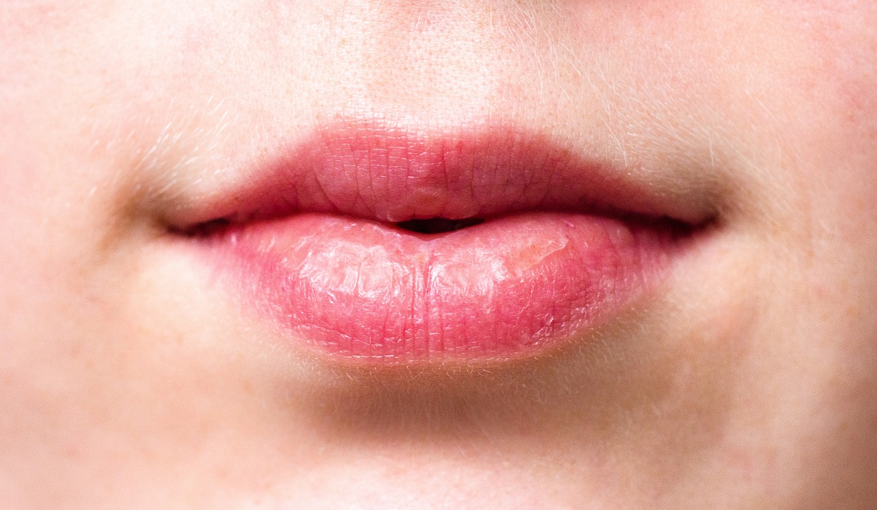 Read more about the article כמה זמן מחזיק בוטוקס בשפתיים? כל מה שצריך לדעת